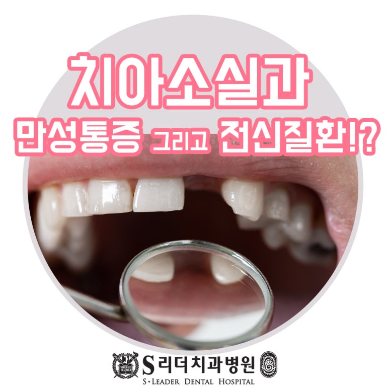 능동치과 치아소실과 만성통증, 전신질환과 관련해 관련 이미지 1