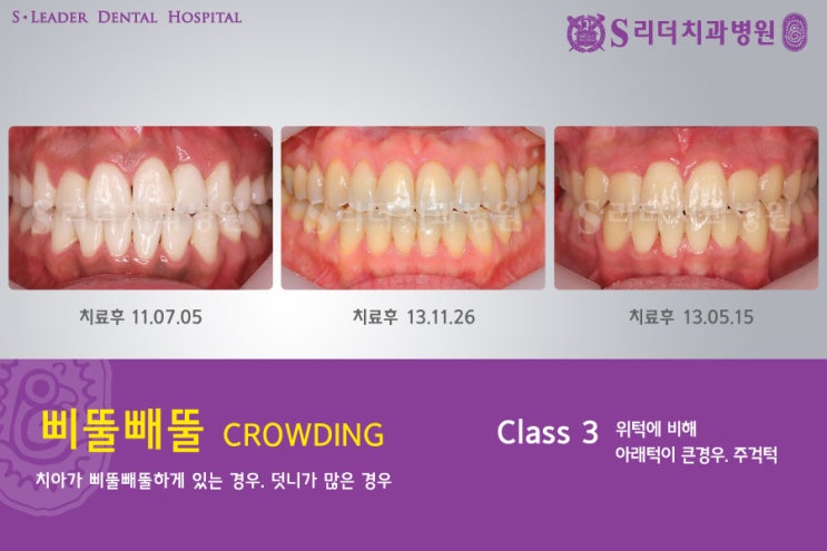 건대교정치과 내 마음에 쏙 드는 교정치과 어때요? 관련 이미지 9
