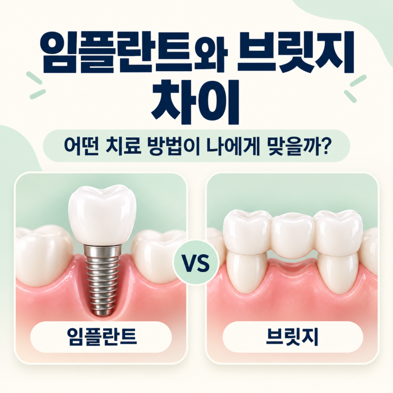 광진구임플란트와 브릿지 차이, 어떤 치료 방법이 나에게 맞을까? 관련 이미지 1