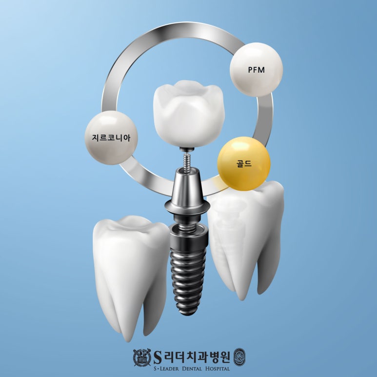 건대치과 임플란트 건강보험 보장에 대한 제안 궁금하다면 관련 이미지 3