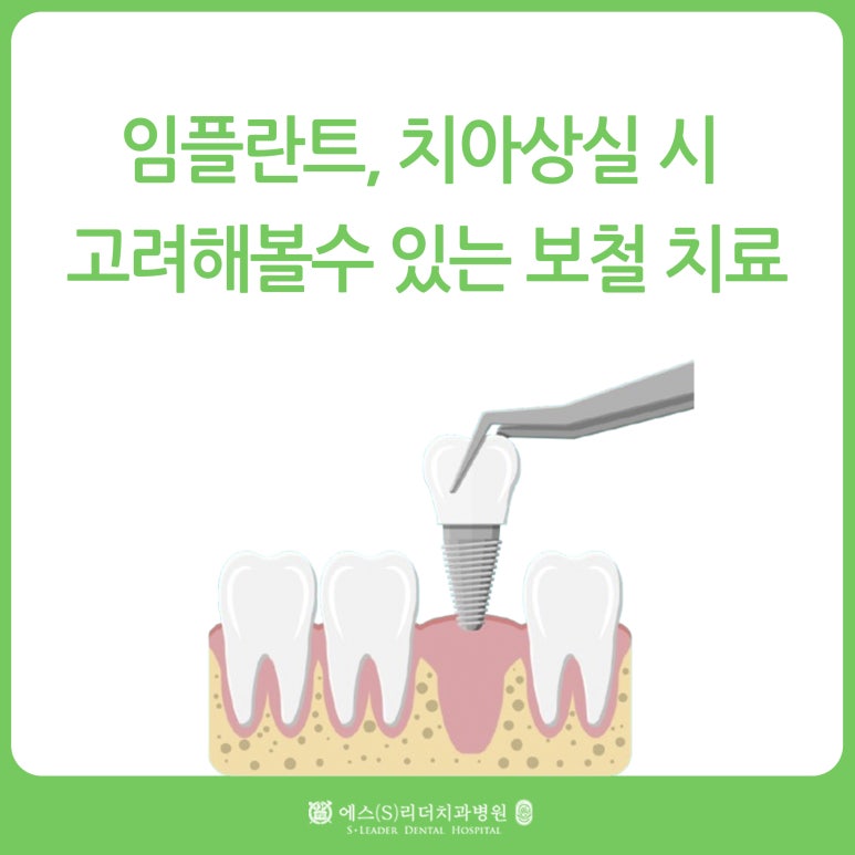 서울임플란트, 치아상실 시 고려해 볼 수 있는 보철치료 종류는? 관련 이미지 1