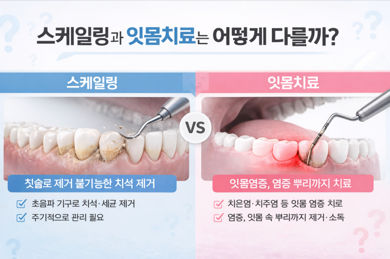 건대입구치과 | 잇몸병은 왜 조용히 진행될까? 초기 신호 체크리스트 10가지 관련 이미지 8