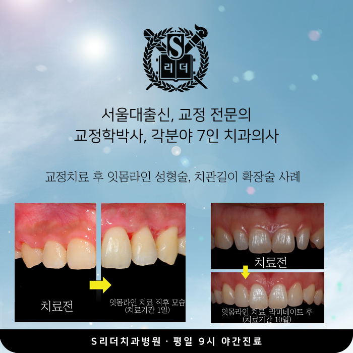 광진구치과, 치아교정 기간 왜 사람마다 다를까요? 관련 이미지 7