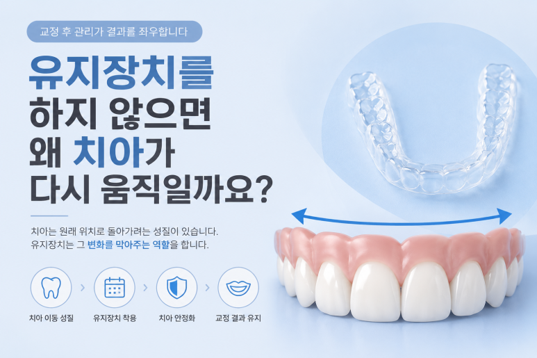 아차산역치과|유지장치 안 하면 재교정 가능성 높아질까요? 관련 이미지 3