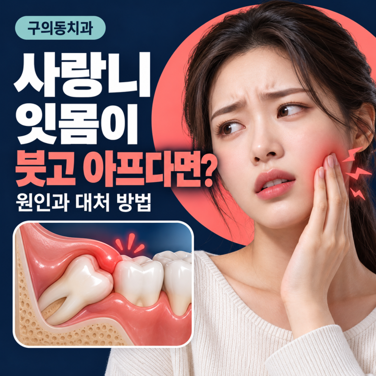 구의동치과, 사랑니 잇몸이 붓고 아프다면? 원인과 대처 방법 관련 이미지 1