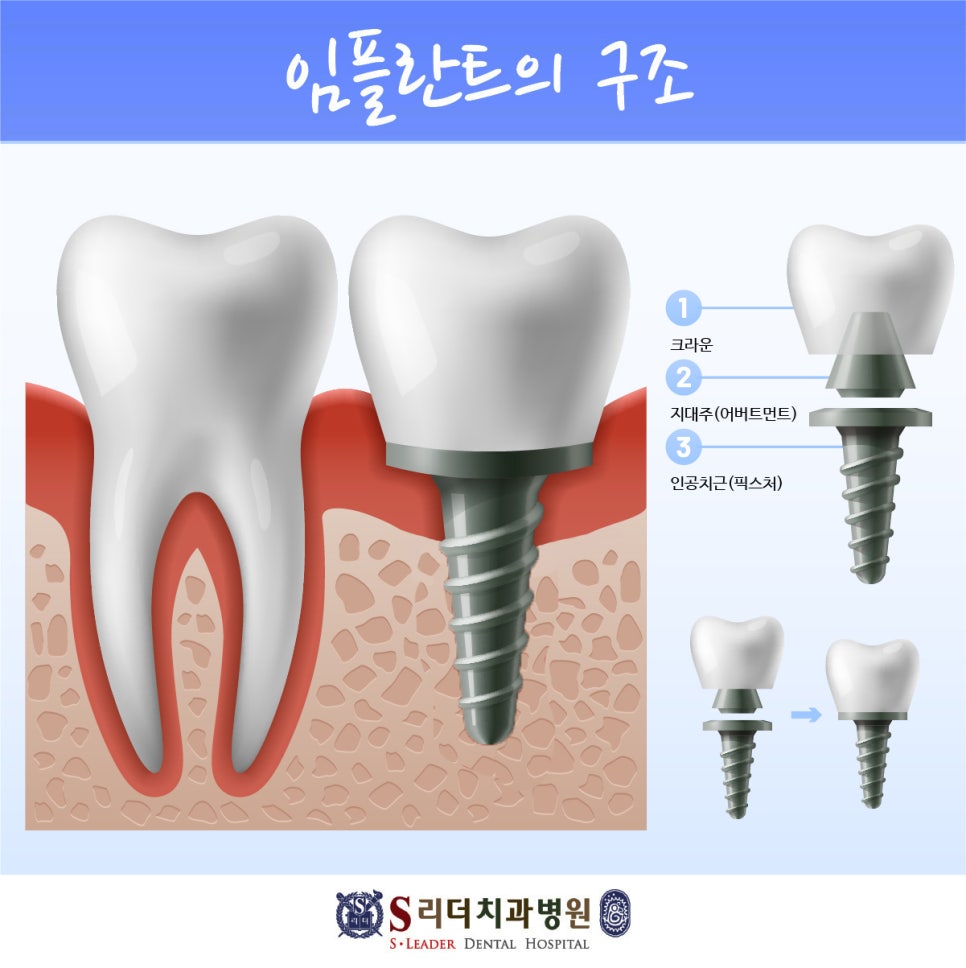건대입구치과 치주인대 역할과 중요성에 대해 관련 이미지 2