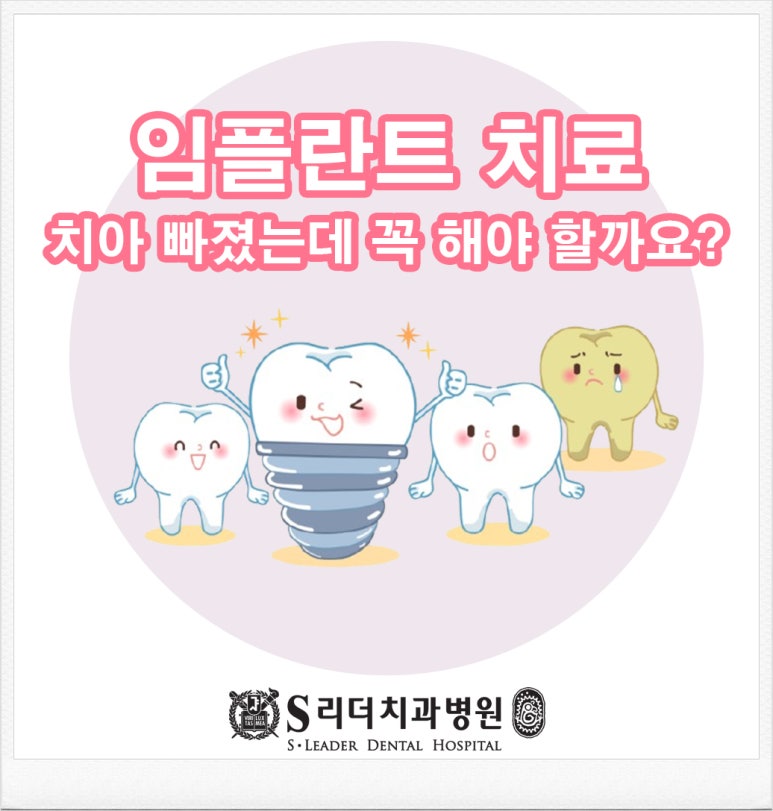 장안동임플란트, 치아 하나 빠졌는데... 꼭 임플란트를 해야 할까요? 관련 이미지 1