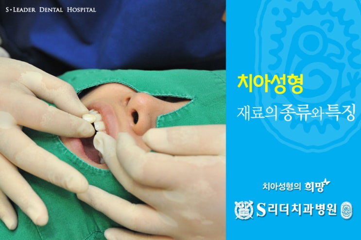 건대치과 치아성형 잘하는 곳 궁금해? 관련 이미지 3