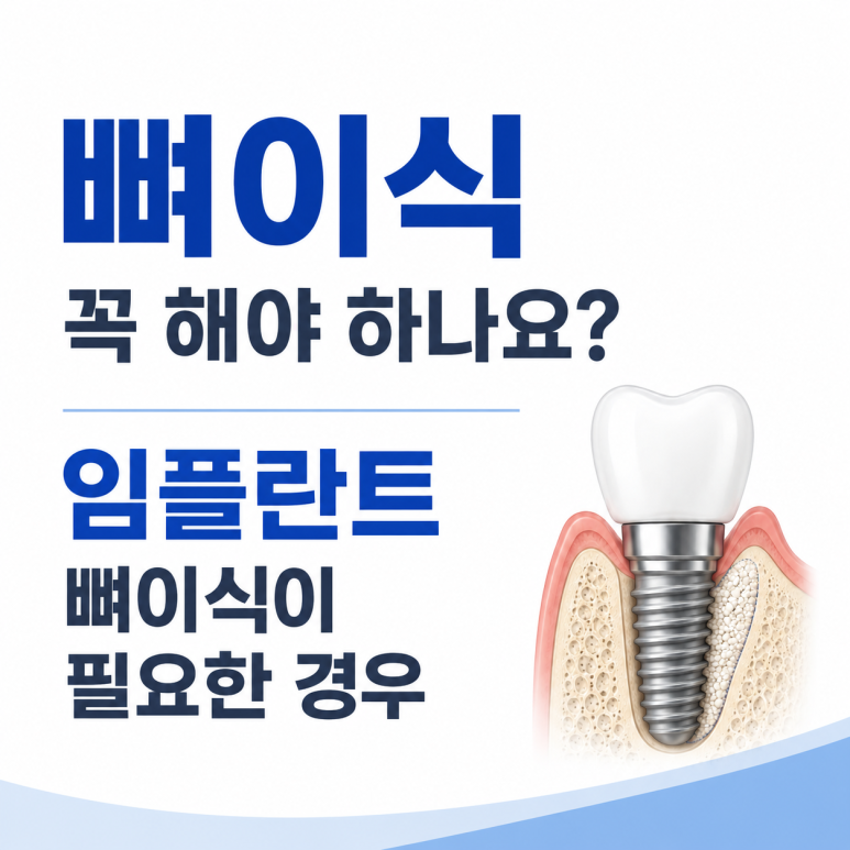 광장동치과, 뼈이식 꼭 해야 하나요? 임플란트 뼈이식이 필요한 경우 관련 이미지 1