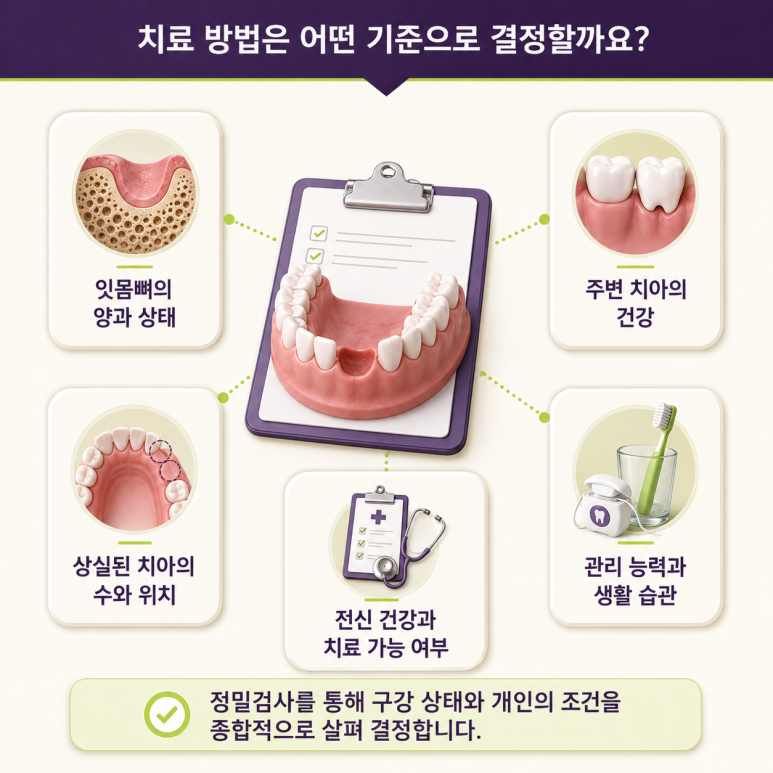 성수동임플란트, 치아 상실 후 임플란트·브릿지·틀니 어떤 차이가 있을까? 관련 이미지 11