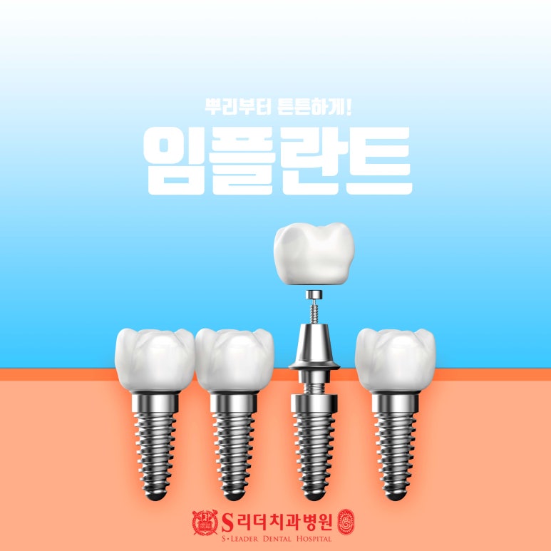 광진구임플란트 신중히 결정해야 하는 이유에 대해 관련 이미지 6