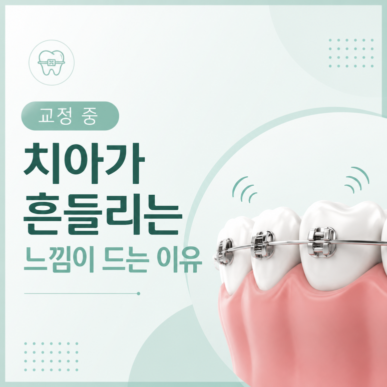 군자동치과 교정 중 치아가 흔들리는 느낌이 드는 이유 관련 이미지 1