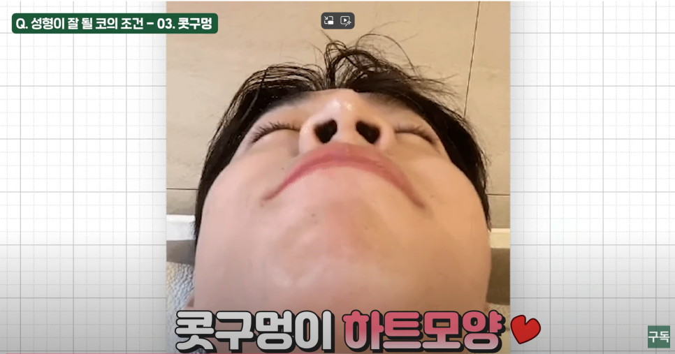 과연 나는 로또 맞을 코인가?(feat.코성형하면 대박나는 조건들) 관련 이미지 6