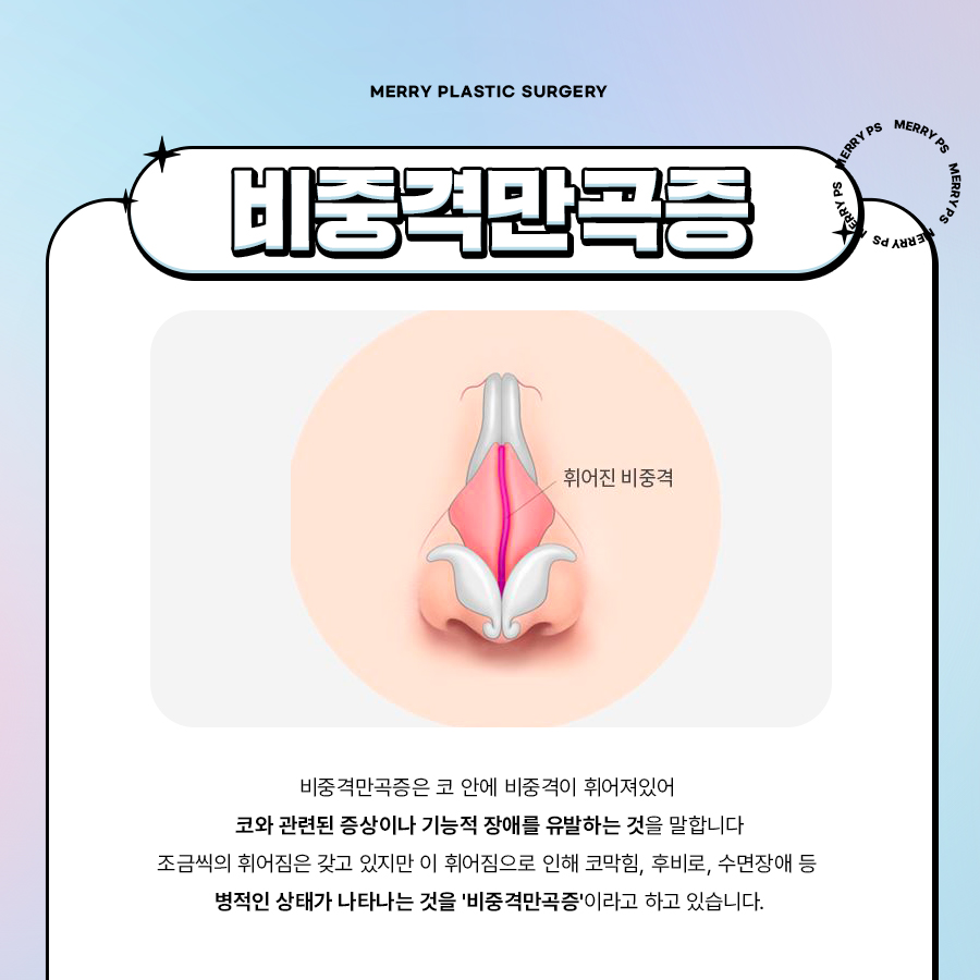비중격만곡증 기능코로 자연스럽고 숨쉬기 편한코 관련 이미지 2