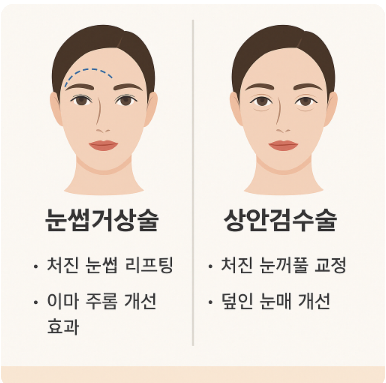 메리이마거상 :: 내시경을 이용한 이마거상술, 차이점과 흉터, 수술 내용까지 정리해봐요. 관련 이미지 1