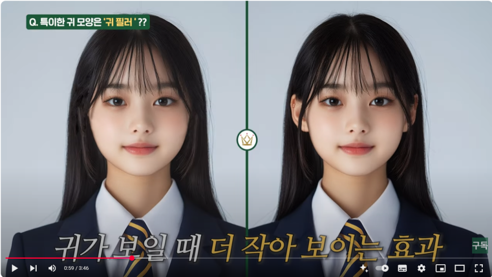 귀필러 :: 얼굴을 작아보이게 하는, 윤곽수술을 한듯한 착시효과, 귀필러 방법, 유지기간, 주의사항 관련 이미지 2