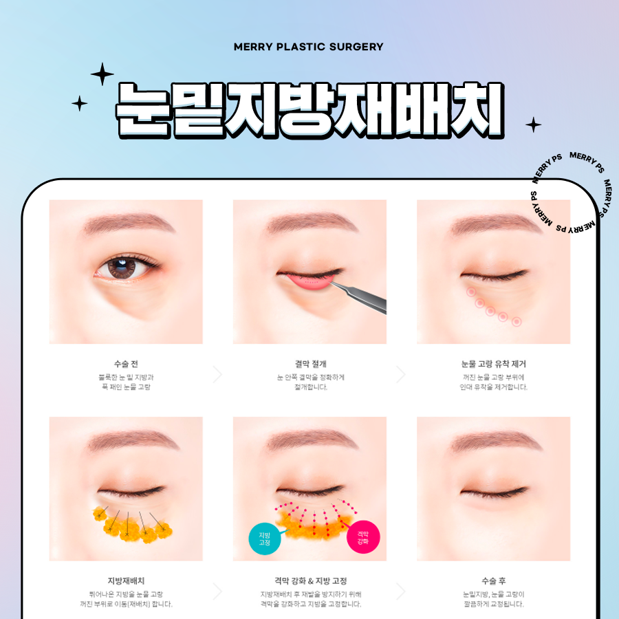 For a More Vibrant Eye Area with Under-Eye Fat Repositioning at Apgujeong Station image 4