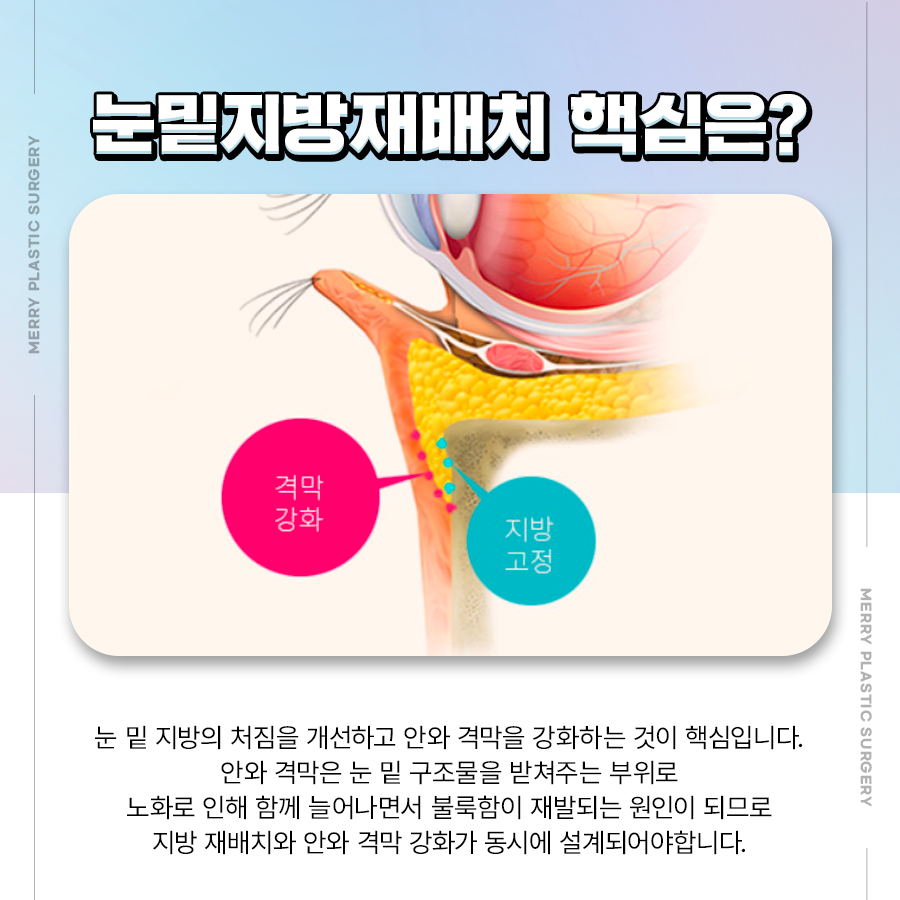 Merry Under-Eye Fat Repositioning: Depending on the Cause of Bulging and the Degree of Symptoms image 4