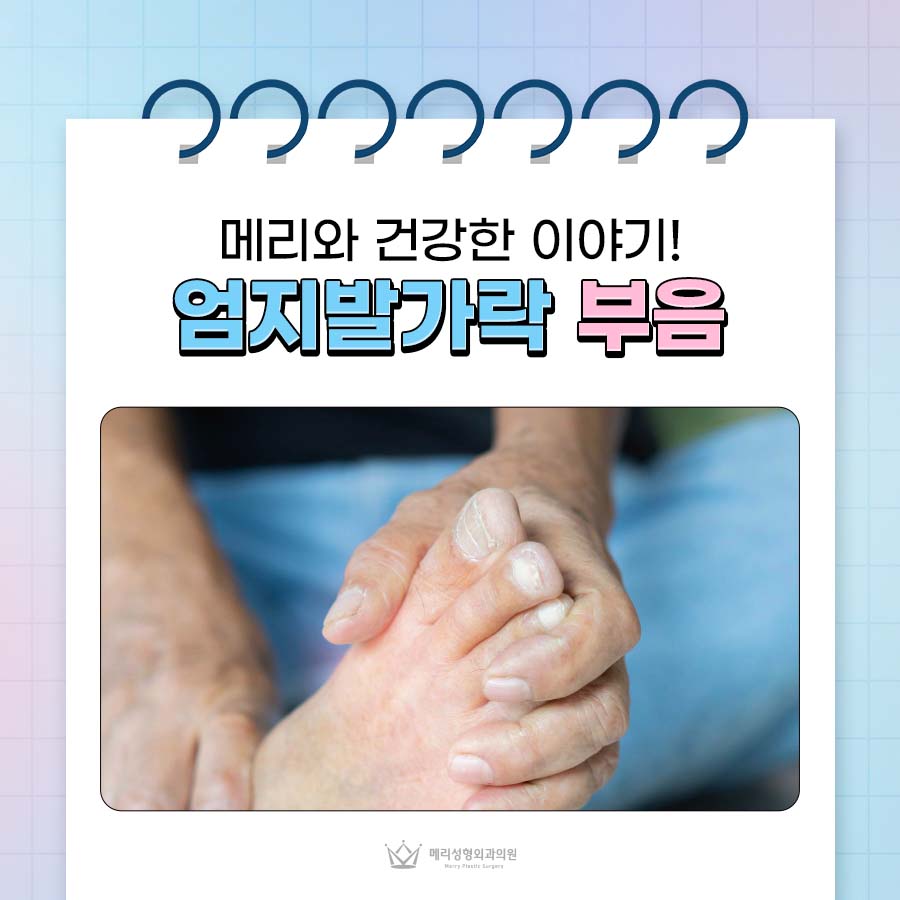 What Causes Big Toe Swelling and Pain? Are These Early Symptoms of Gout? image 1