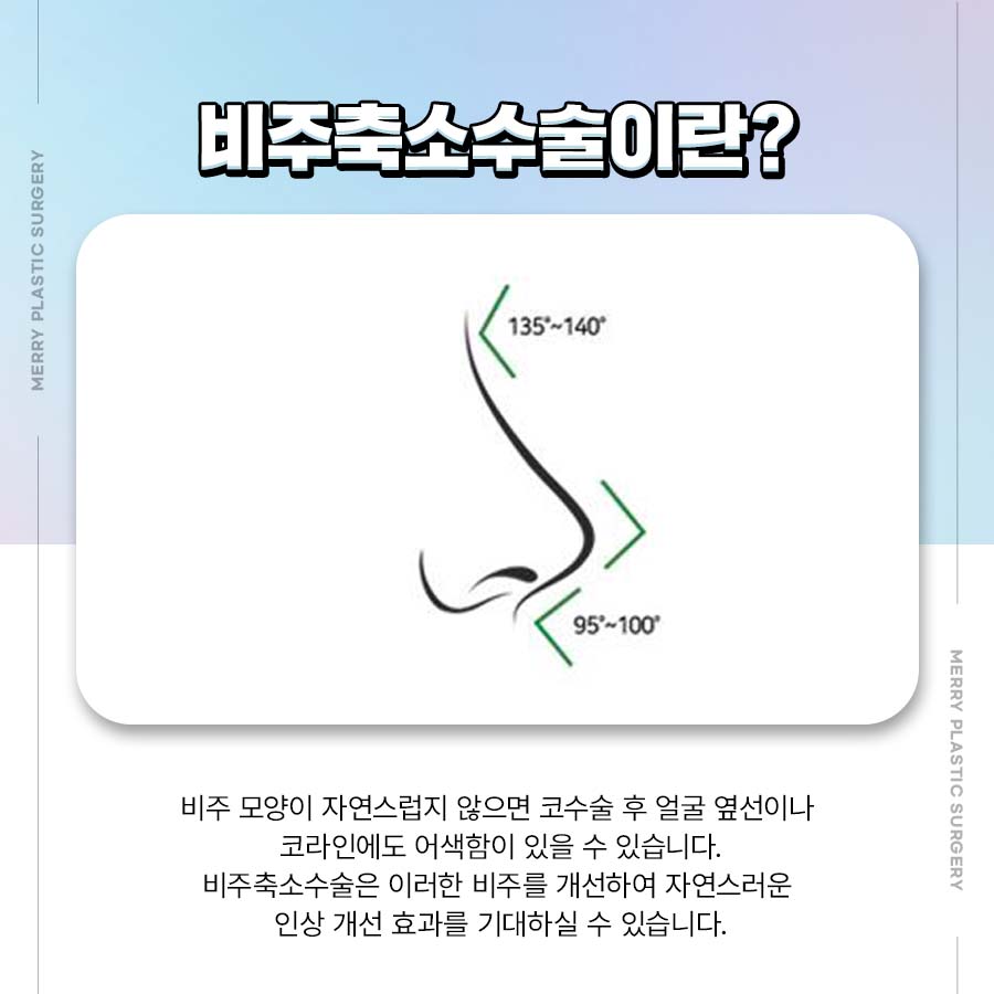 비주축소수술 이목구비를 고려한 자연스러운 디자인 관련 이미지 3