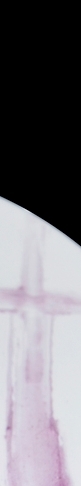 Merry Non-Implant Rhinoplasty, Preserving the Characteristics of Autologous Tissue image 19