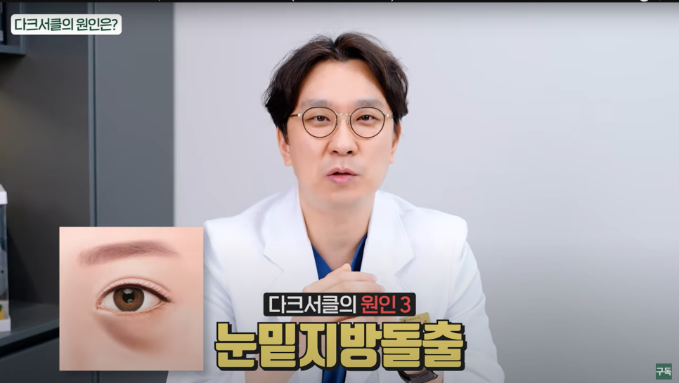 다크서클, 아무리 노력해도 안 없어지던 이유는 바로 이것! 관련 이미지 8