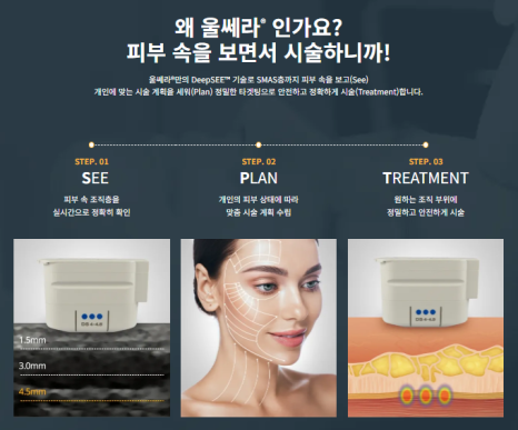 Home Beauty Devices :: Comparison with Hospital Medical Devices, Effects, Side Effects, and Price image 6