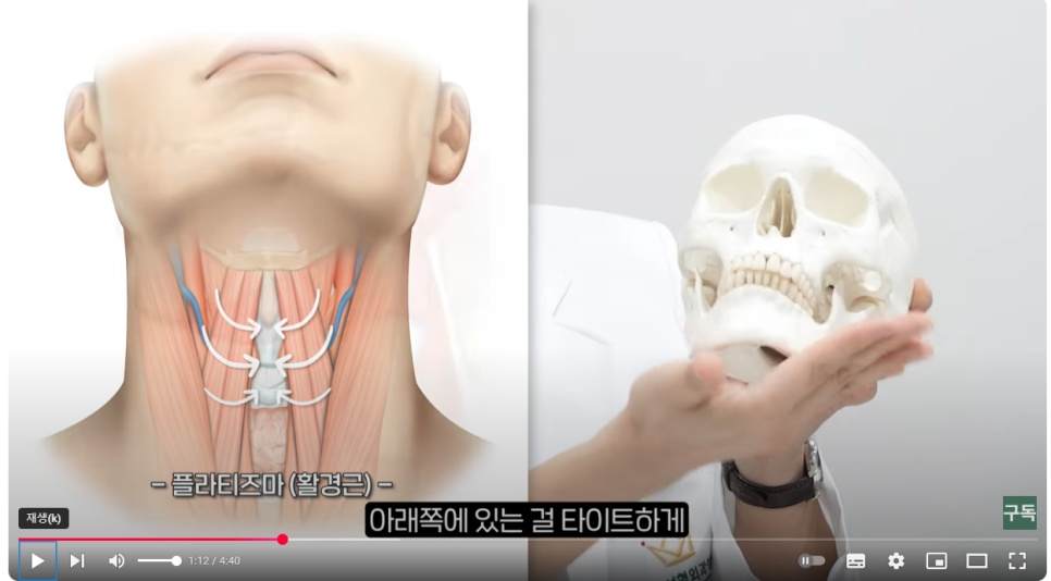 Tensioning Device :: Double Chin Muscle Tying, Facial Liposuction, Non-Surgical Post-Op Care image 3
