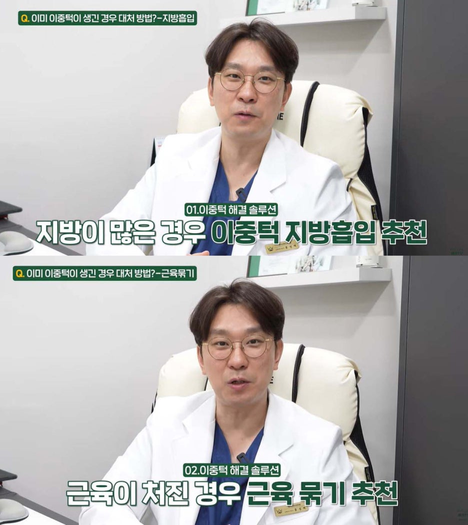 이중턱제로 얼굴지방흡입으로 쏙빼는 방법 관련 이미지 4