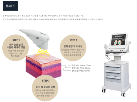 커스텀 덴서티, 커스텀 울쎄라 :: 한 샷도 남김없이 이펙트를 발휘하게 만드는 전략적 접근법 관련 이미지 3