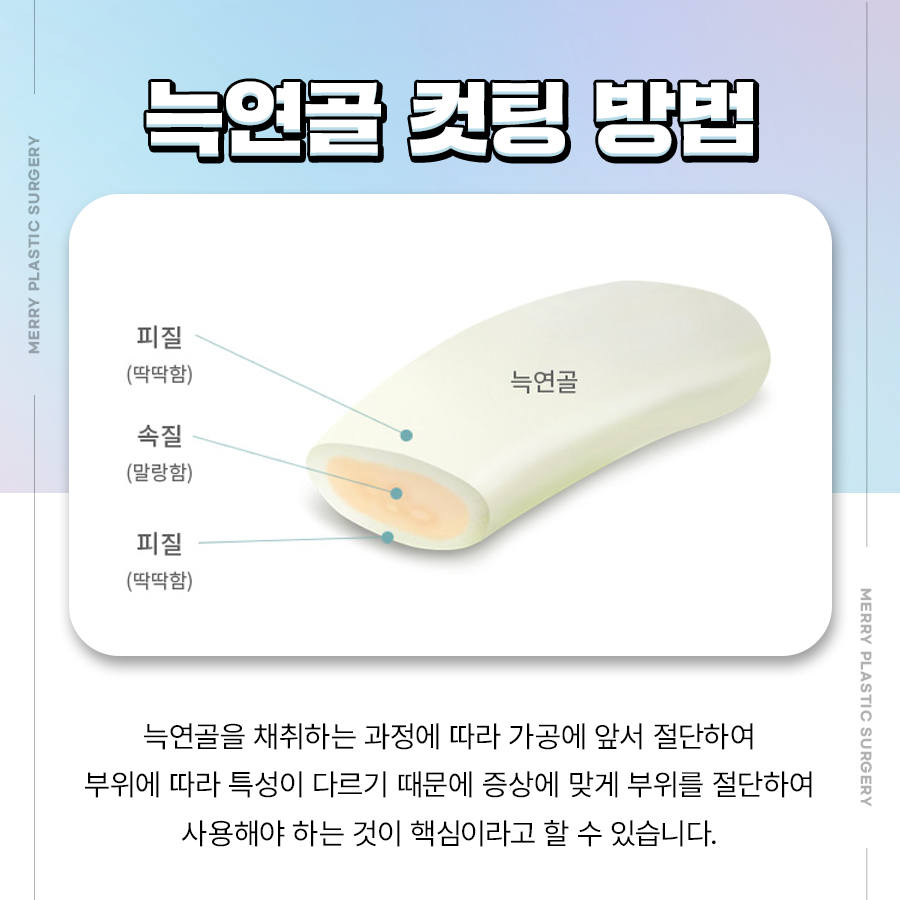 코끝재수술 연골 적절하게 채취하기 위해서는 관련 이미지 5