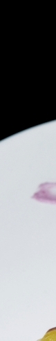 Merry Non-Implant Rhinoplasty, Preserving the Characteristics of Autologous Tissue image 14