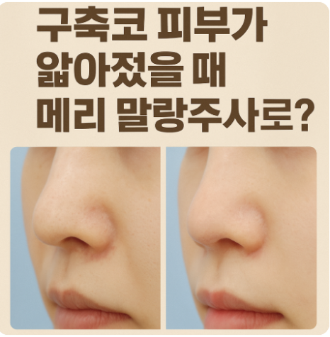 Contracted Nose :: If you’re concerned about thinned skin from a contracted nose, visible silicone, or a step-off at the nasal tip silicone — Mary Mallang Ju-sa image 2