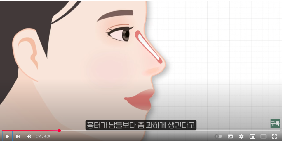 A regenerative injection that softens a contracted nose, the Malangi Injection :: For those who want revision rhinoplasty as soon as possible and for those who want to improve revision results image 2