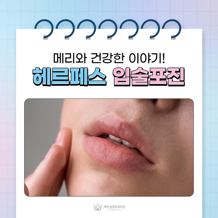 Herpes Lip Cold Sores Type 1 Treatment: Immunity Is the Key image 1
