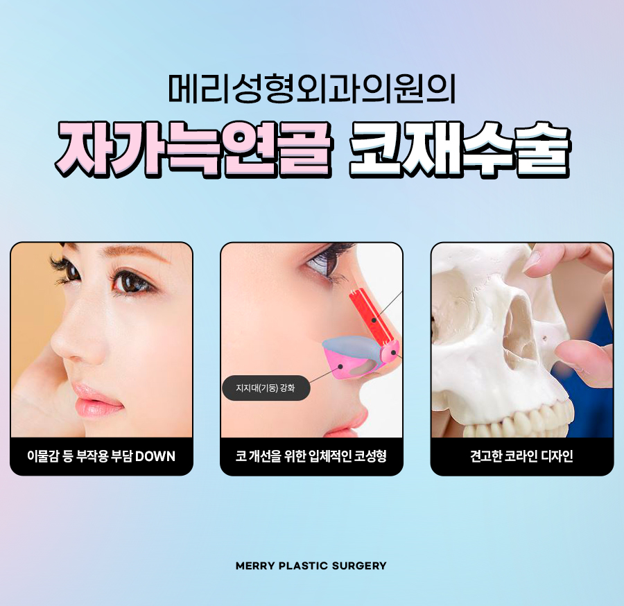 자가늑연골 코재수술 메리에서 마지막이 될 수 있도록 관련 이미지 4