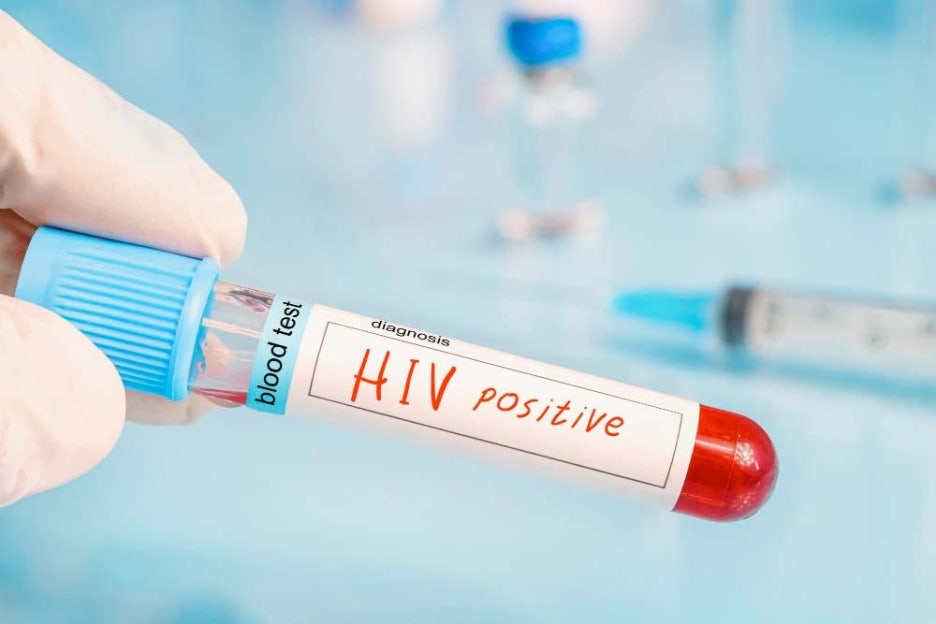 hiv 바이러스 증상 보균자 뜻 치료방법은 관련 이미지 5