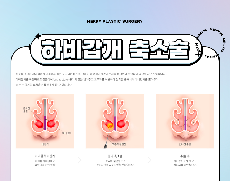 Types of Functional Rhinoplasty Near Sinsa Station: For a Beautiful Nose That’s Easy to Breathe Through! image 4