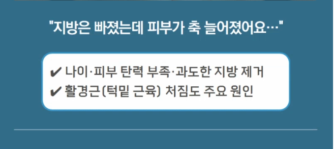 얼굴지방흡입만 하면 다시 쳐지는 이유? 이중턱살제거 핵심은 &lsquo;근육&rsquo;입니다 관련 이미지 3