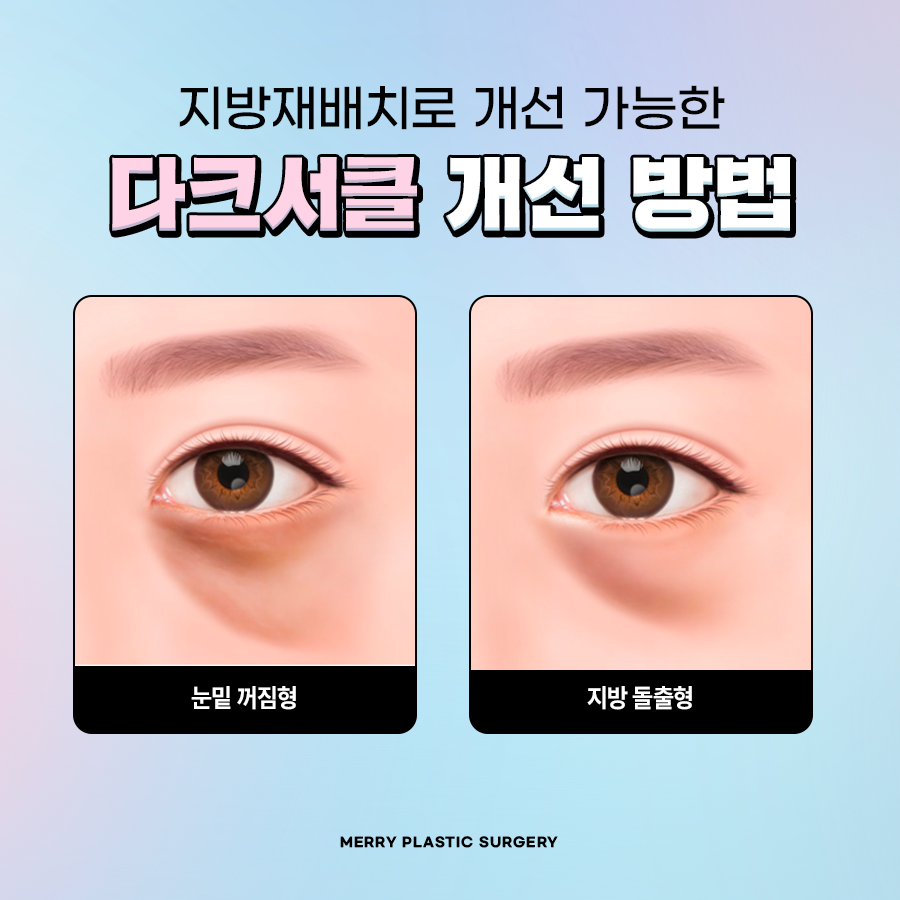 For a More Vibrant Eye Area with Under-Eye Fat Repositioning at Apgujeong Station image 3