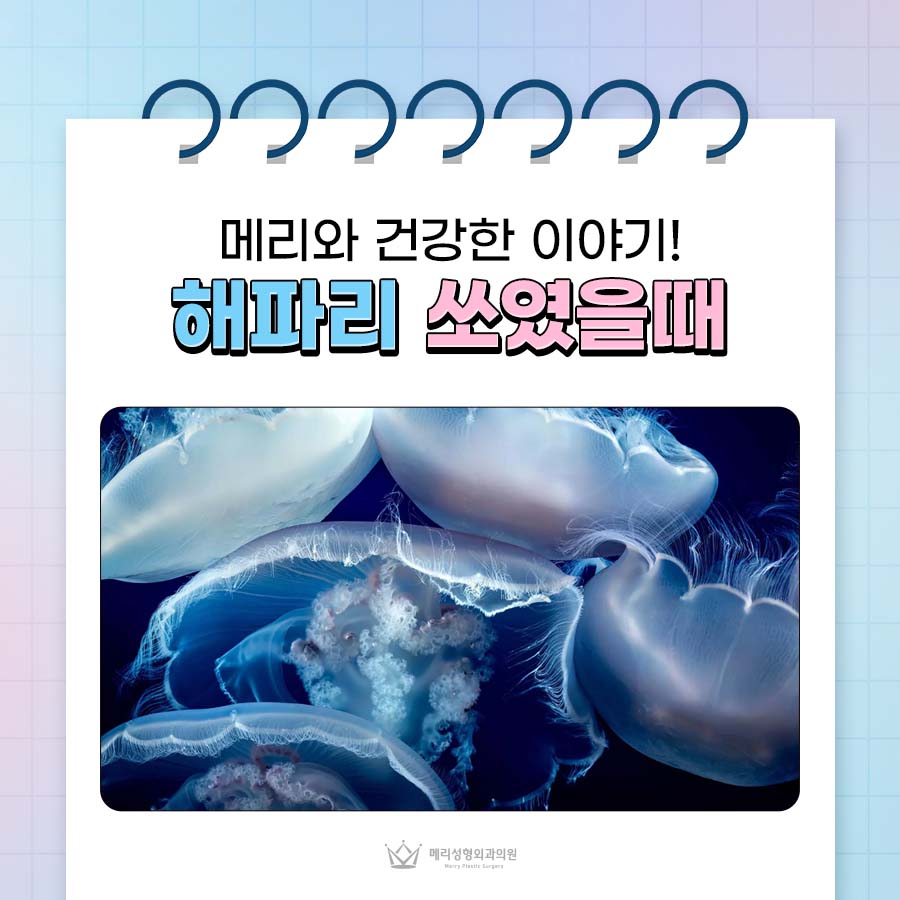 해파리 쏘였을때 증상 대처요령 정리 관련 이미지 1