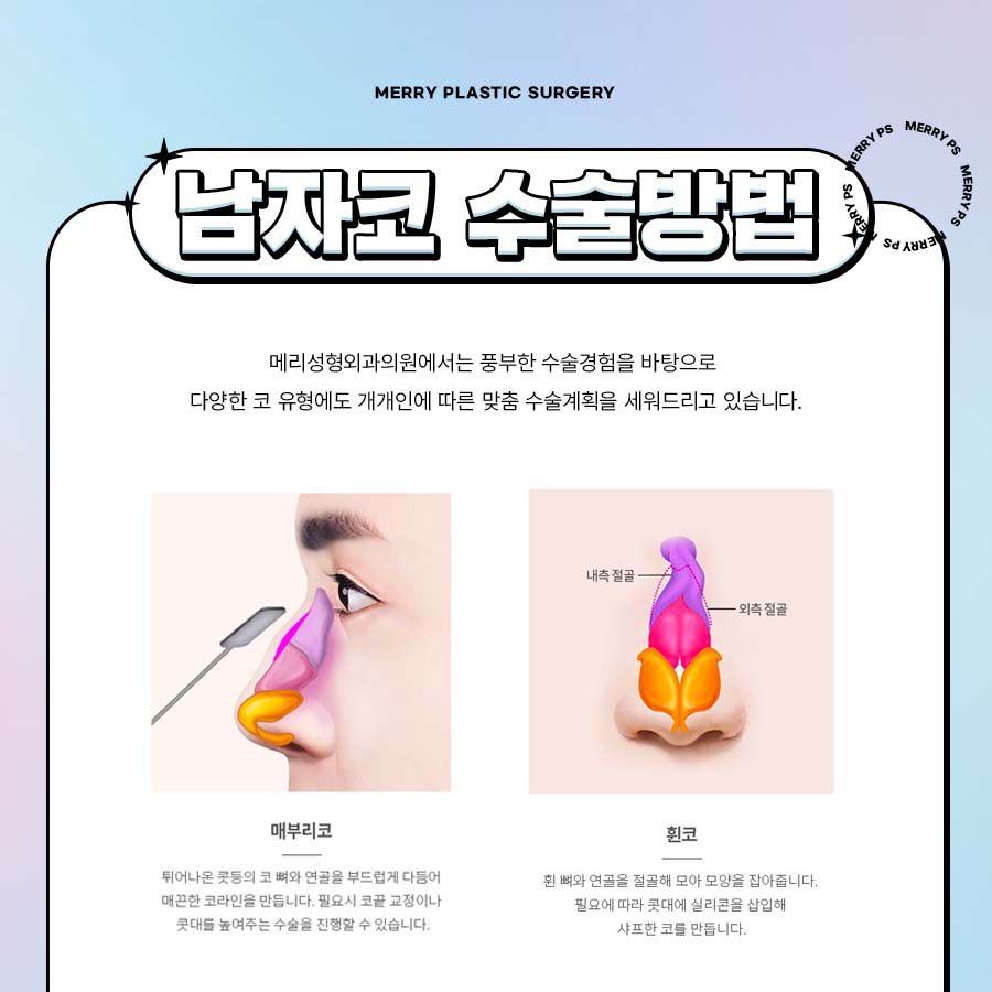 Merry Male Rhinoplasty for a Refined Masculine Look with a Straight Nose image 4