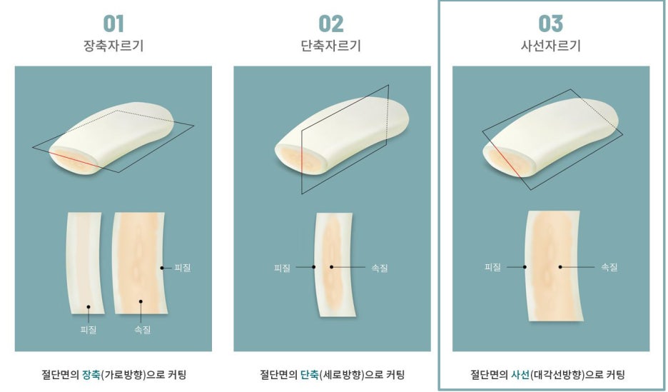 자가늑연골 코재수술 메리에서 마지막이 될 수 있도록 관련 이미지 6