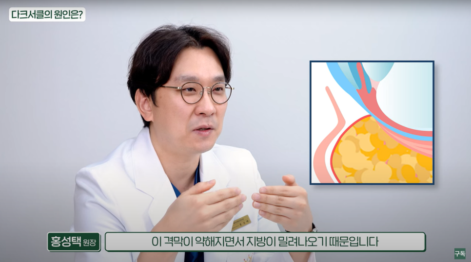 다크서클, 아무리 노력해도 안 없어지던 이유는 바로 이것! 관련 이미지 9