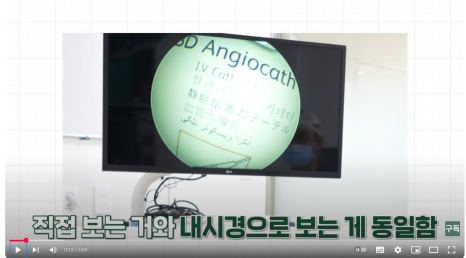 내시경 이마거상술, 흉터 걱정 없이 젊음을 되찾으세요! 관련 이미지 1