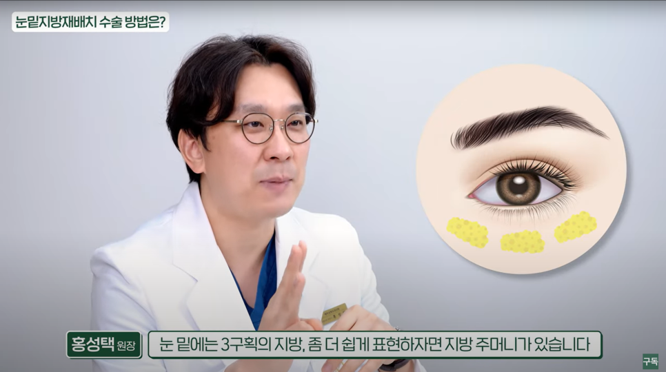 다크서클, 아무리 노력해도 안 없어지던 이유는 바로 이것! 관련 이미지 10