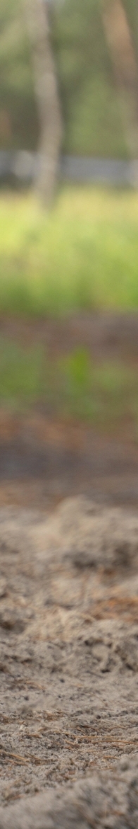 논현 코성형 라인 측면에서 봤을 때 예쁜 코는? 관련 이미지 21