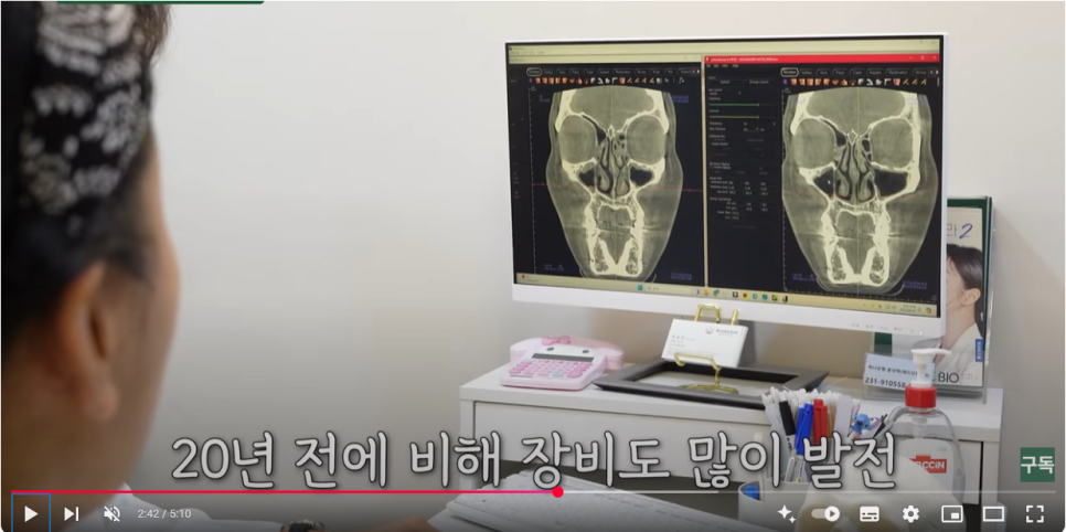 중년 코성형/코재수술 ::  안전하고 자연스럽게 부작용은 최소화 관련 이미지 3