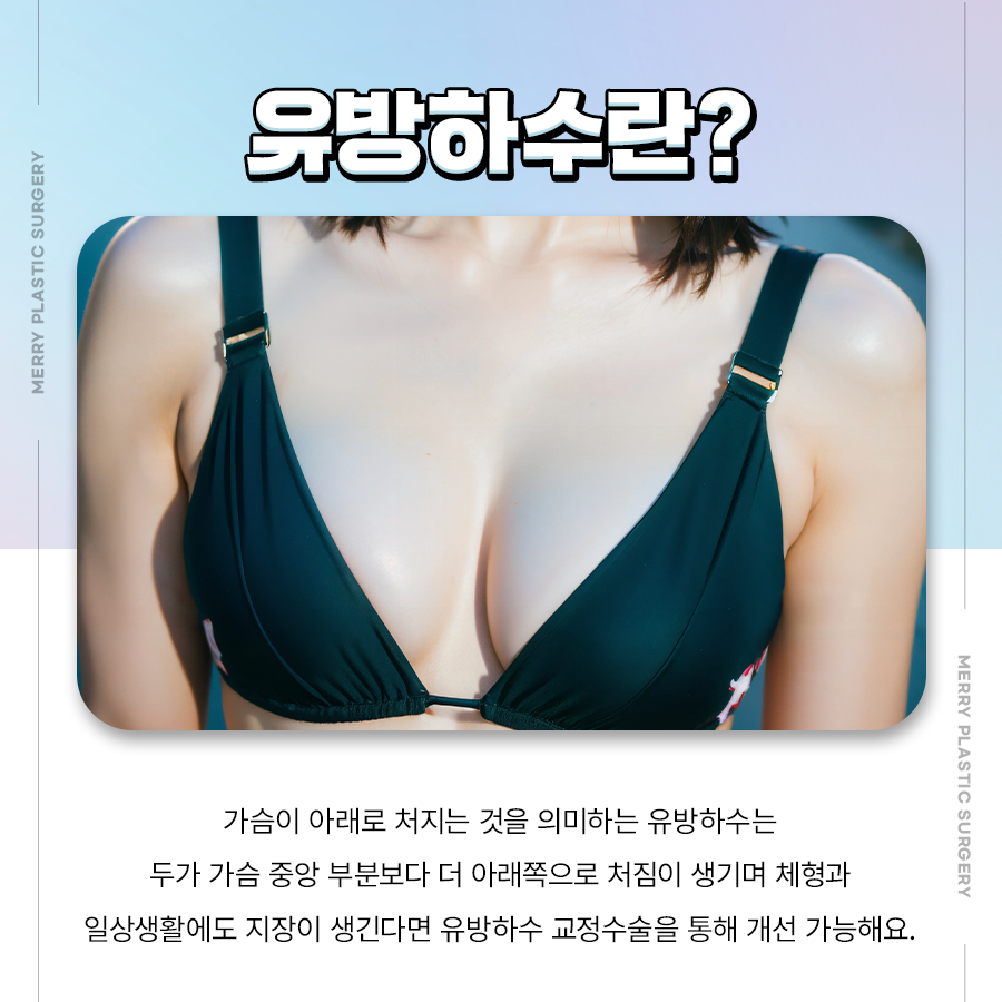 유방하수 교정수술 출산 후 처진 가슴 고민이라면 관련 이미지 2