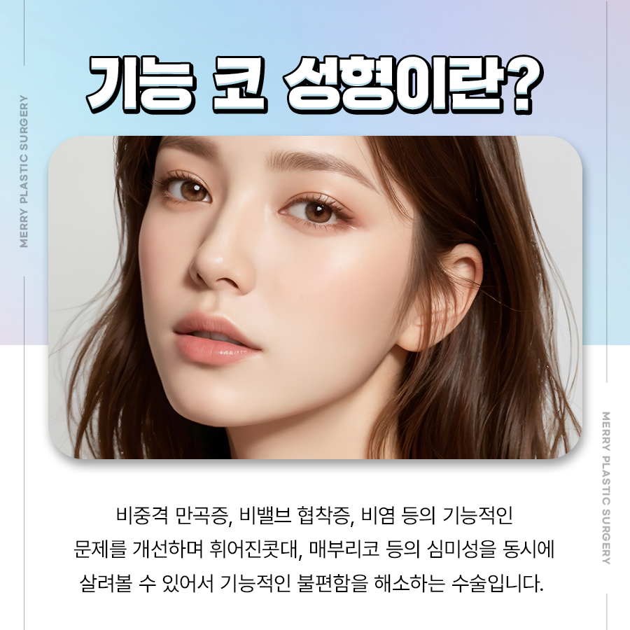 비염 하비갑개절제술 기능 코 성형으로 호흡까지 편한 코 관련 이미지 2